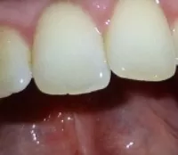 Zahnpflege