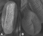 Elektronenmikroskopische Aufnahme von Pollen der Ackerschmalwand (Arabidopsis thaliana) (Max-Planck-Institut fr Molekulare Pflanzenphysiologie, Potsdam)
